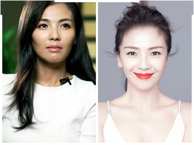 因整容翻车?盘点下被玻尿酸"坑惨"的女明星都有哪些?