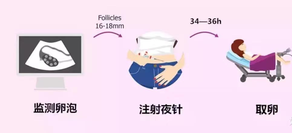 打促排针取卵_打促排针取卵后肚子感觉变大了