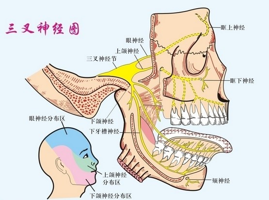 被称为"天下第一痛"的三叉神经痛到底有多痛?