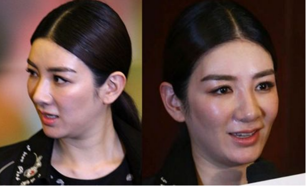 她们曾经不承认整容,如今大变样,网友纷纷回复早已看出整容痕迹