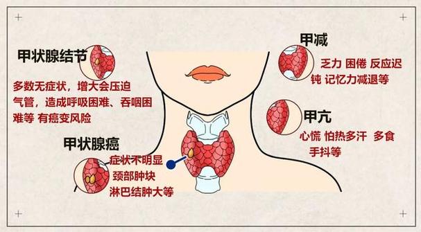 女性甲状腺的前兆图片图片