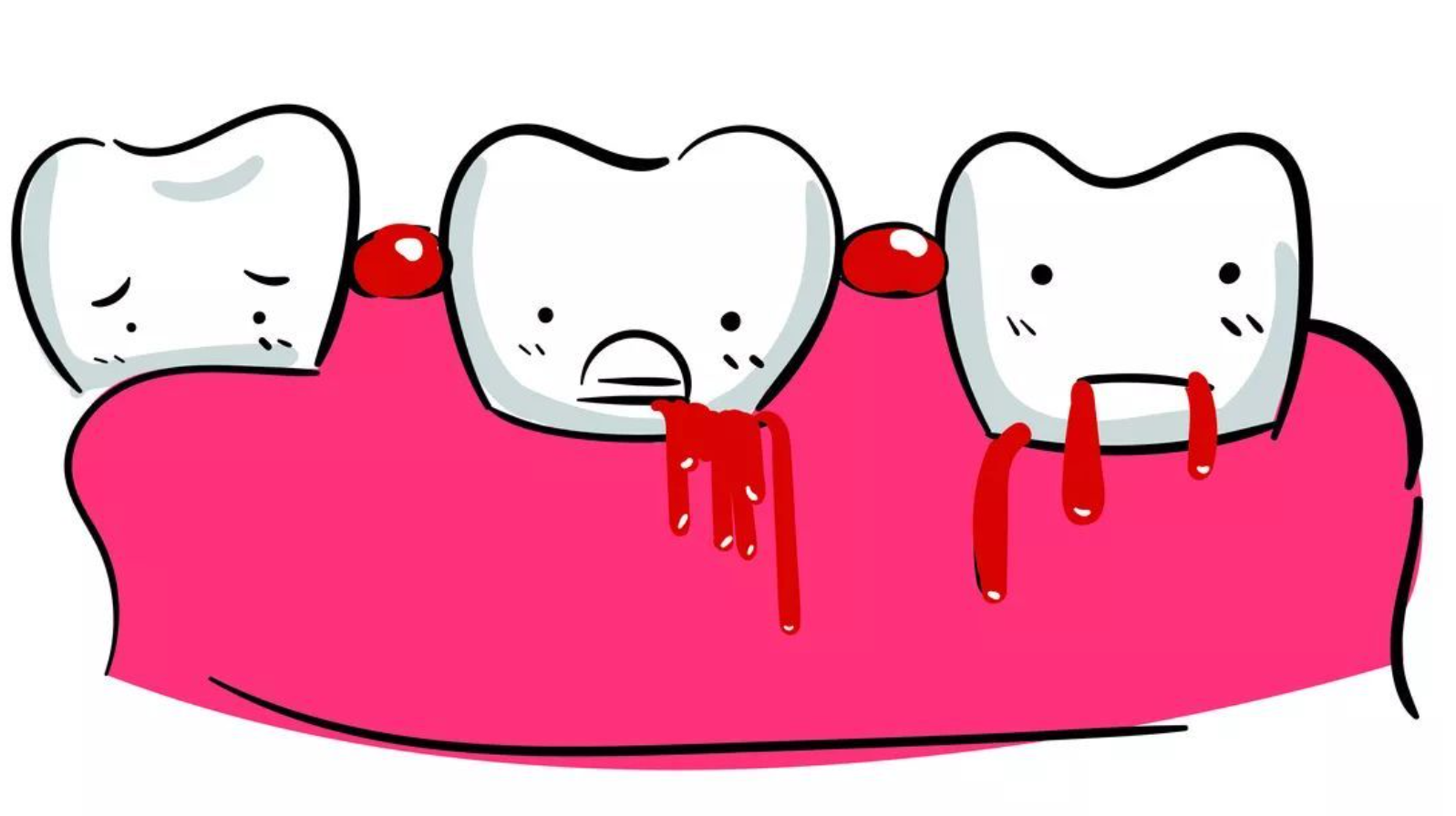 牙龈出血是什么原因?可以试试这个小方法!