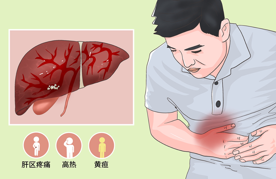 遇上肝硬化怎么办?医生告诉你:这样做才能稳定病情!