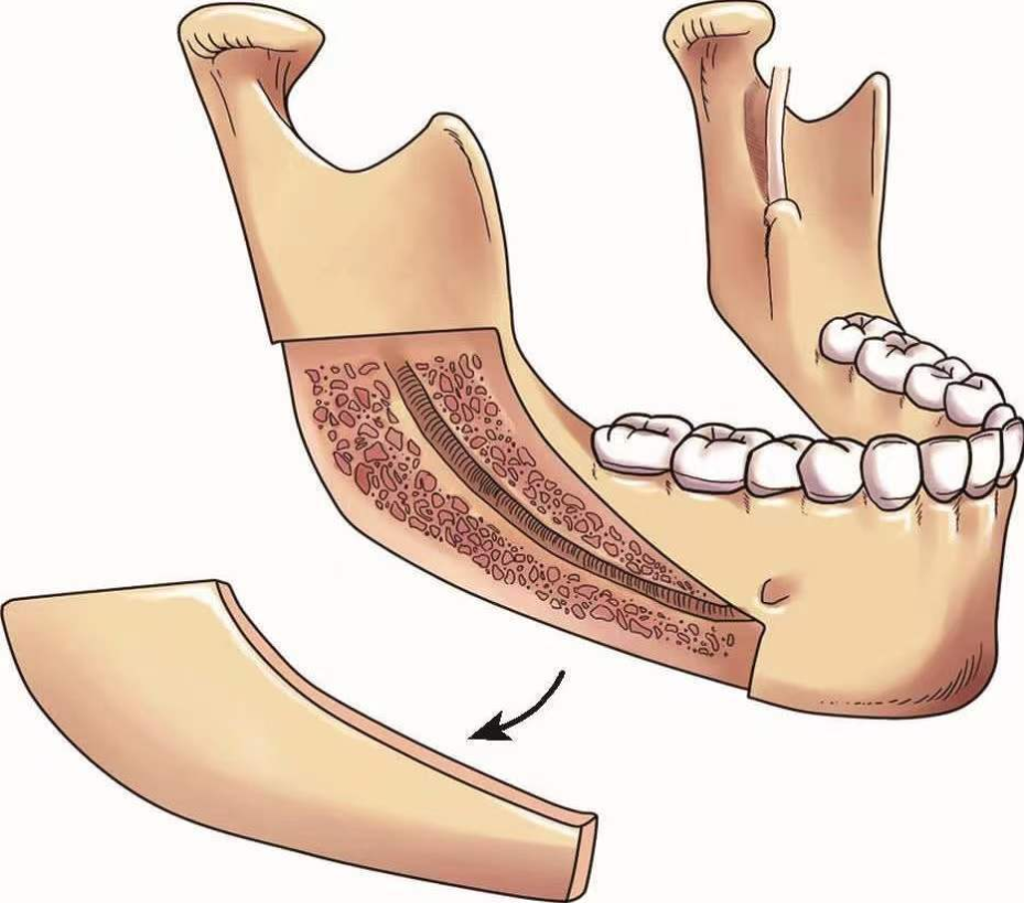 磨外板和劈外板有什么不同?哪种方式效果好