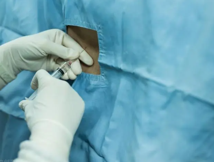 手术选择"硬膜外麻醉"方式好不好?麻醉科医生告诉你