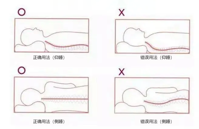 「骨科小知識」頸椎生理曲度變直的危害,原因和日常保養