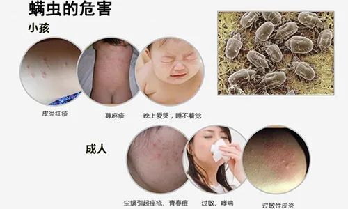 床上螨虫成堆?老保姆教你招笨方法,5分钟,螨虫全消失