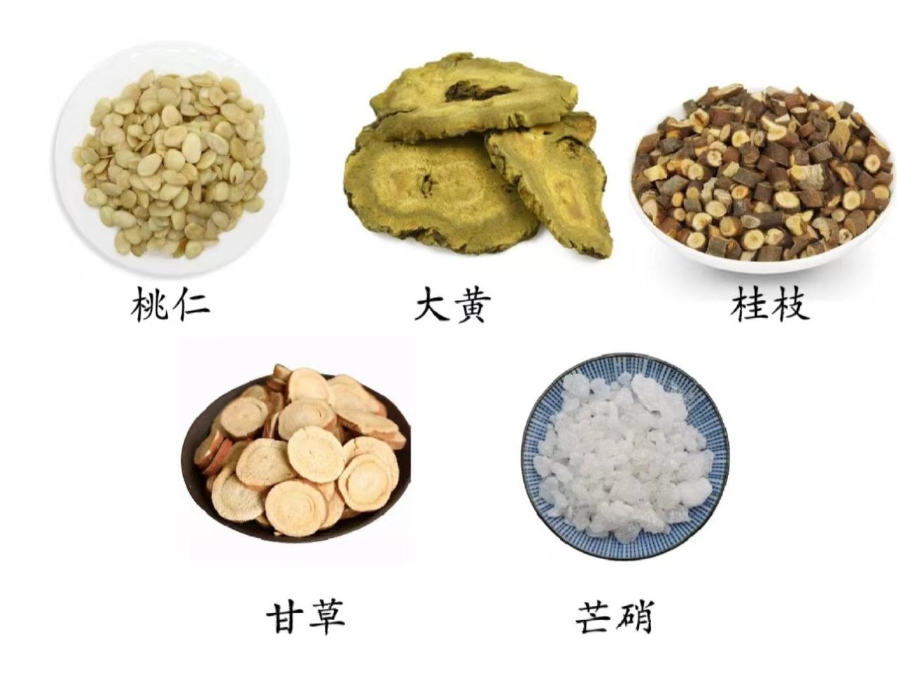 中医"桃核承气汤"治疗急性脑出血,逐瘀泻热