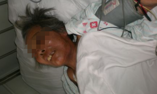 回顾 北京82岁母亲饿死家中,胃像纸一样薄,5个儿子3个被判刑