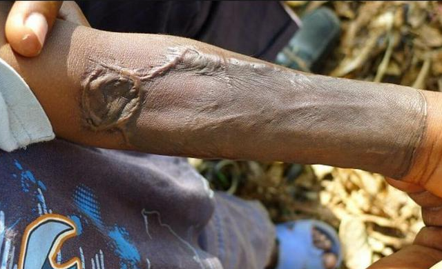 回顾:2016年,四川一女子被活活蒸死,曾惨叫2个小时无人相救