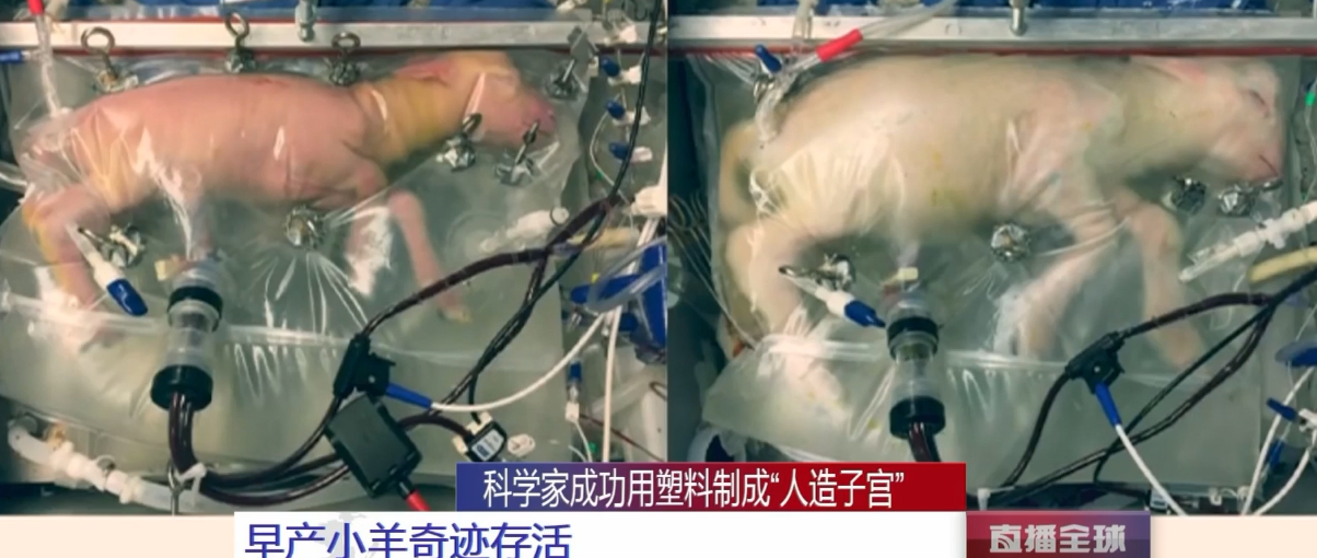 日企利用人造子宫培育出鲨鱼,"人造子宫"或引起伦理问题?