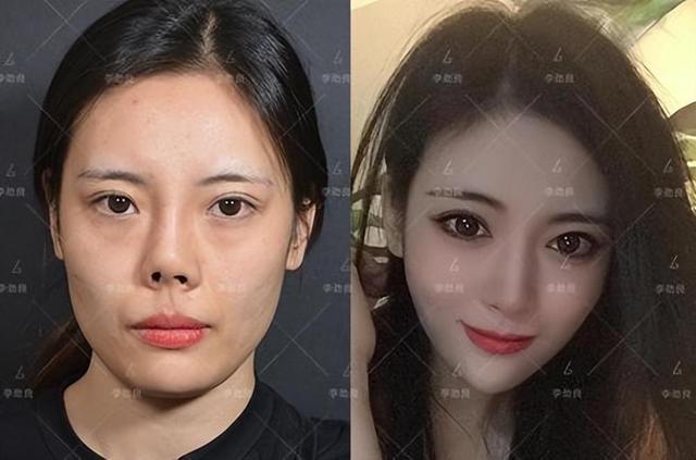 整容大王韩安冉,四婚照片曝光!鼻子太糟糕,隆鼻千万别学她!