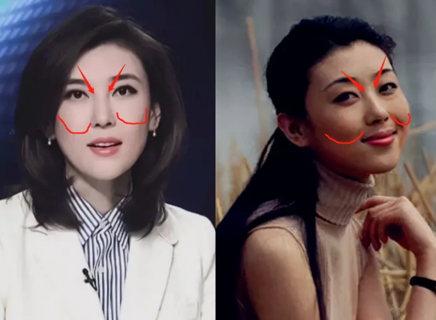 央视女主持集体整容?朱迅嘴歪脸僵撞脸宋小宝,龙洋肿似发面馒头