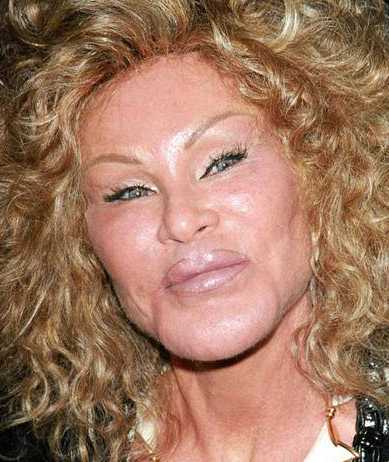 美貌名媛为讨好老公,狂砸千万整容成猫?整容"成功"后反遭抛弃