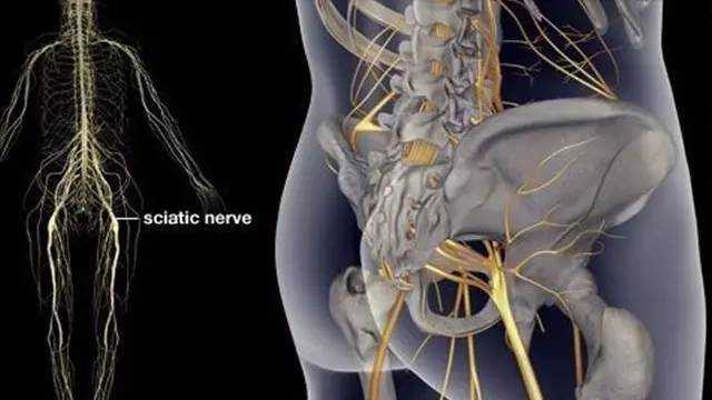 坐骨神经真人位置图图片