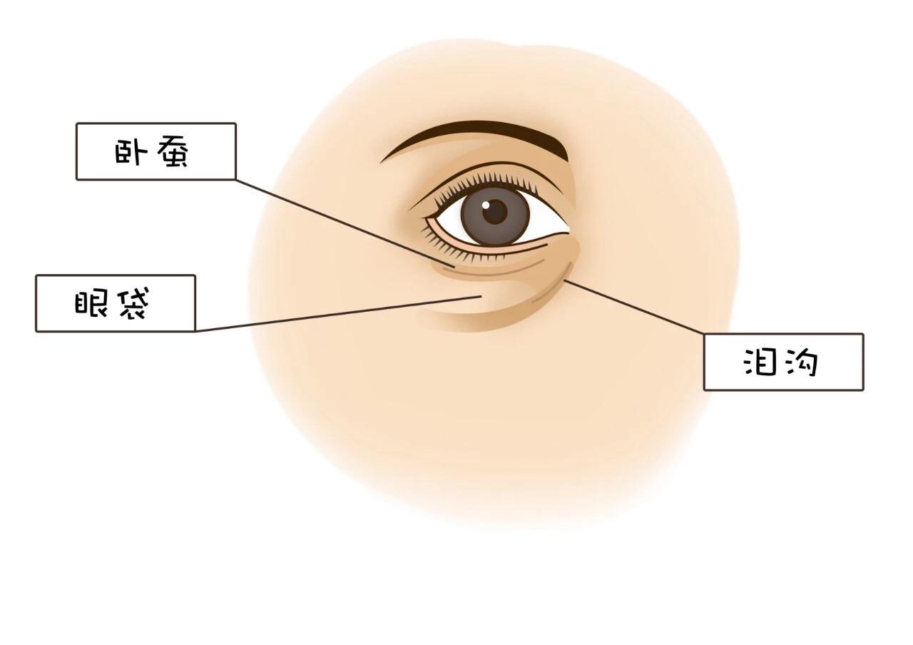 眼袋示意图图片