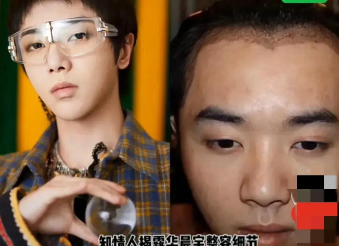 知情人士曝光华晨宇整容前照片,太恐怖了,他这些年到底变了多少