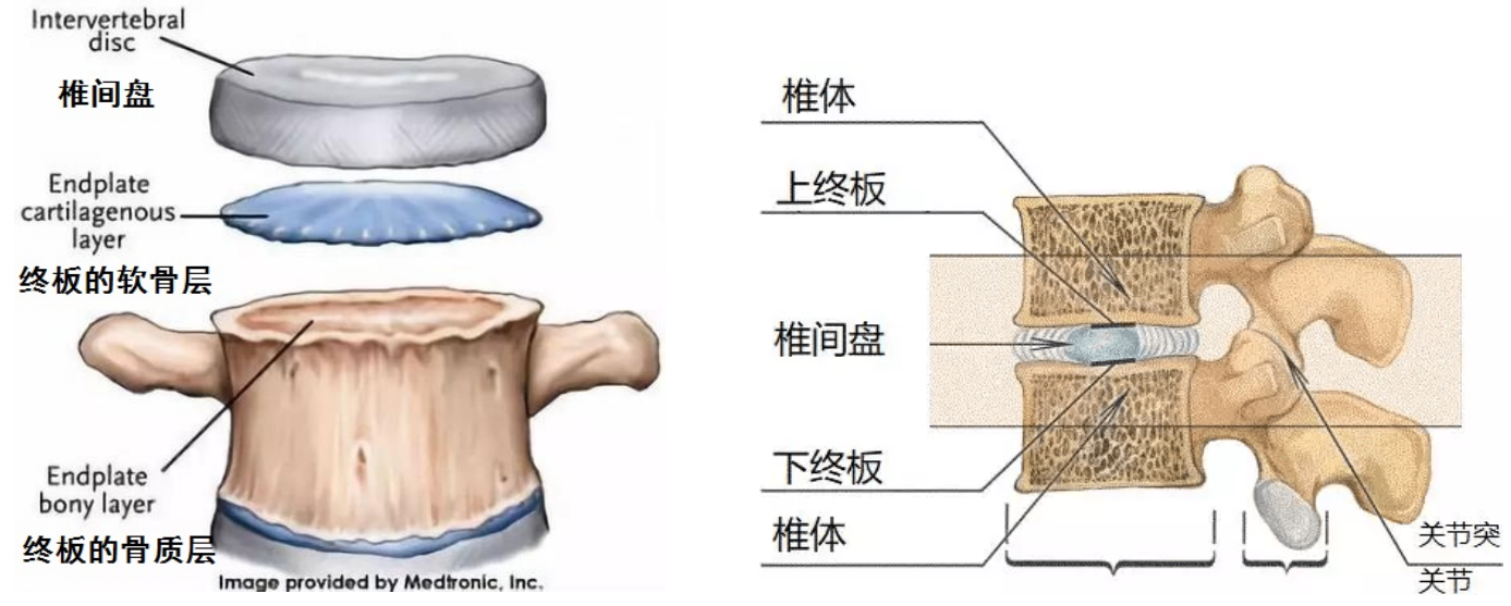 報告單寫著腰椎終板炎,許莫氏結節嚴重嗎?用不用治療?