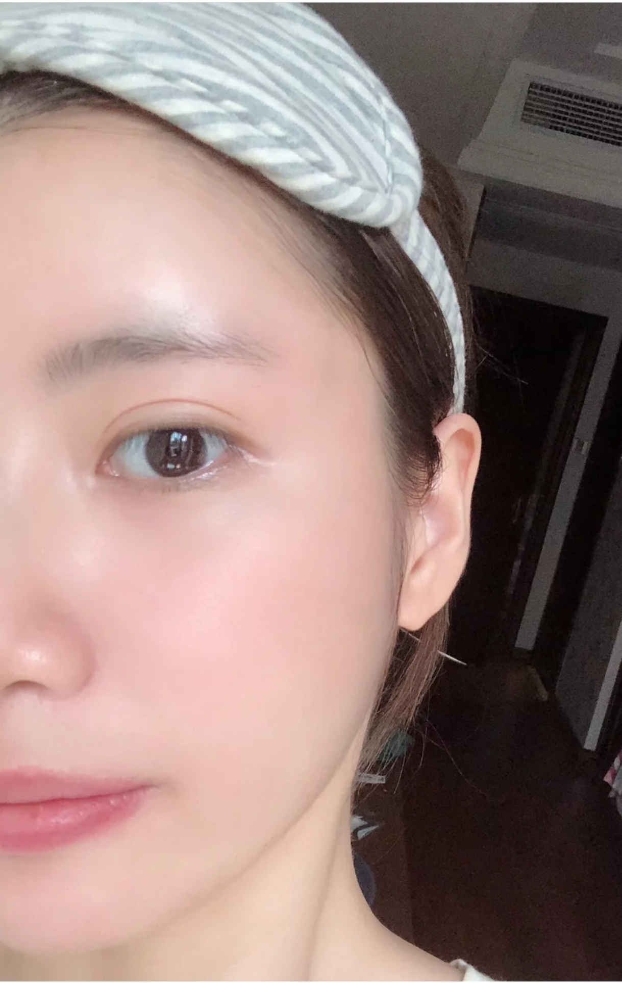 肌肤要想深层补水,水光到底是什么?打完可以维持多久?