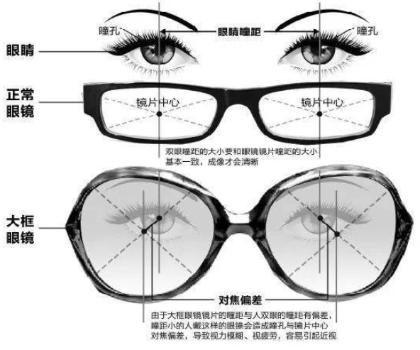 注意!大框眼镜不是随意佩戴的!