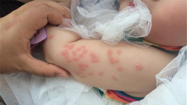 床上"螨虫成堆"?老保姆教你"笨"招,只需5分钟,螨虫全消失