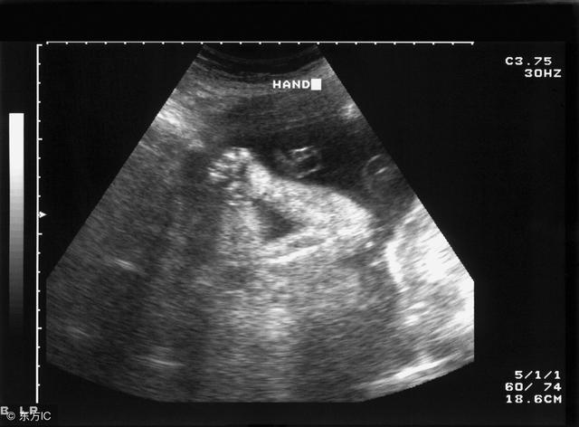 胎儿头尖的图片图片