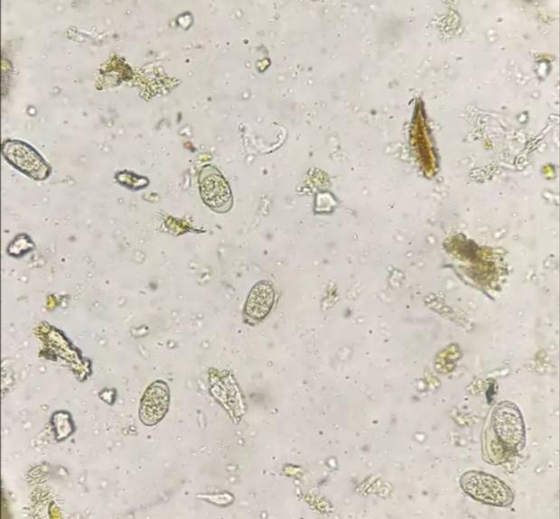 不是细小不是冠状不是肠炎但狗狗就是长期拉稀,请警惕球虫病