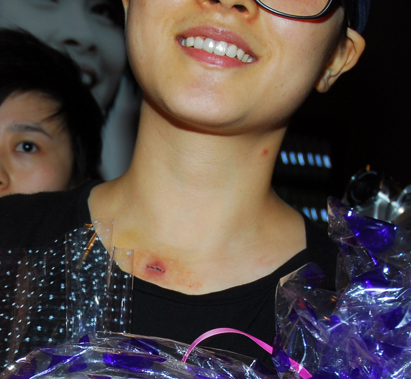 昨天被男友在脖子上种了草莓,怎么消失的快一点?