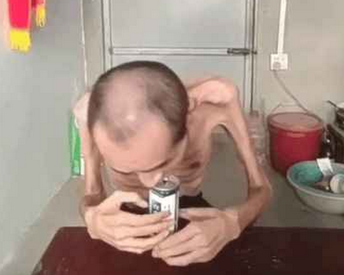 中国最瘦的男人的图片图片