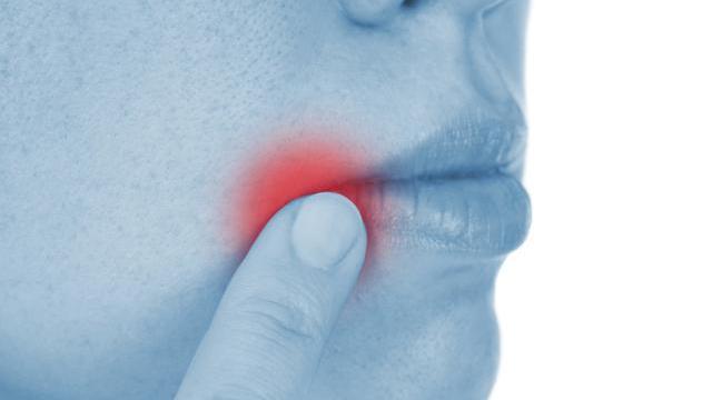 总是口腔溃疡,吃不好也睡不好,怎样可以好得快些?