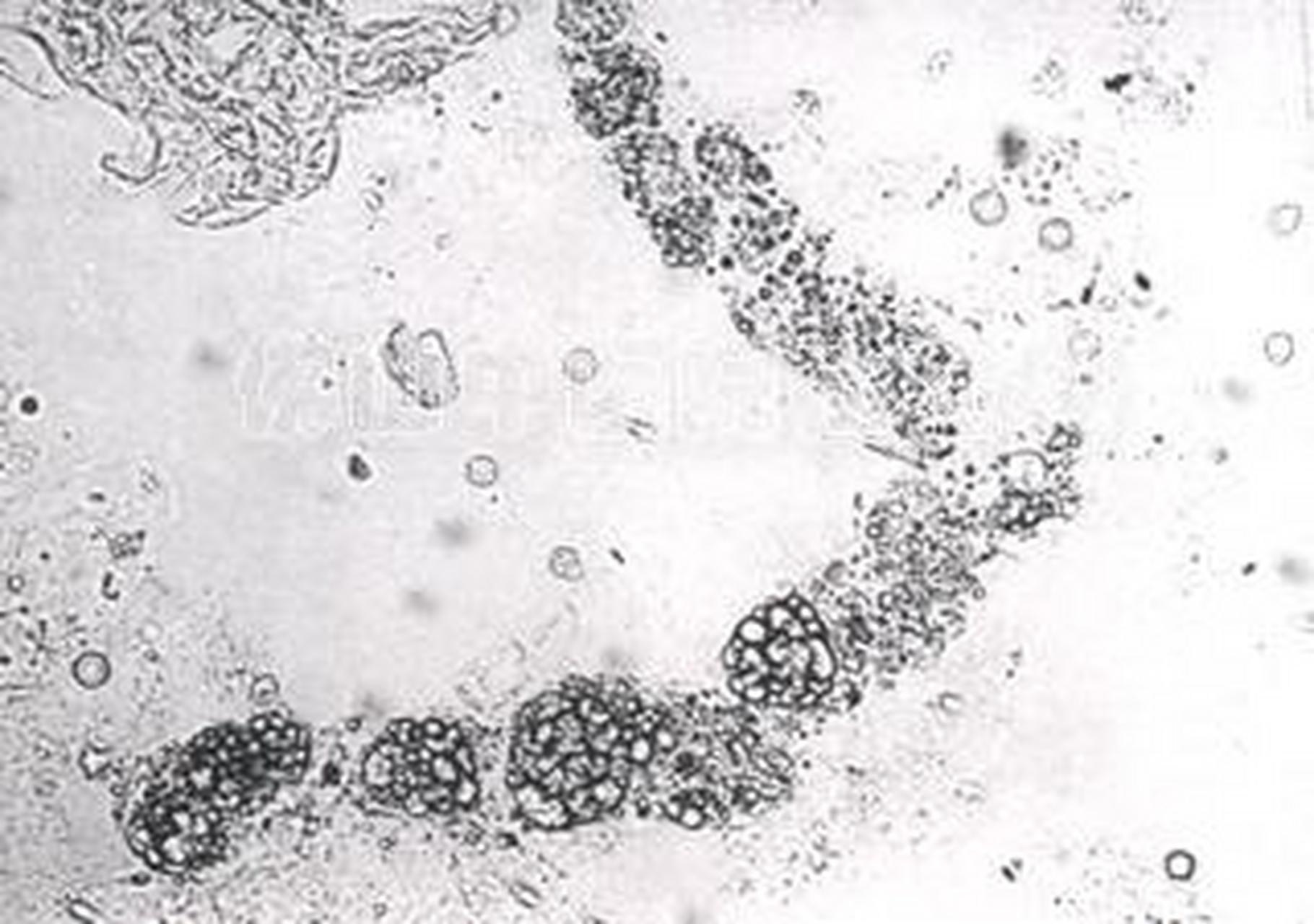 科普知识竞赛#尿液中混有脂肪小滴时称为脂肪尿,尿中含有淋巴液,外观