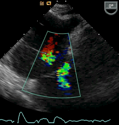 ai诊断心脏病比人类更准?但这只是识图,不是诊断   