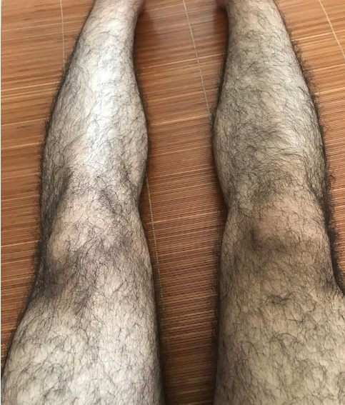 老中医说的"好男一身毛,好女一身膘"什么意思?听听医生怎么说