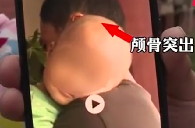 湖南永兴县"大头娃娃"事件最新进展来了