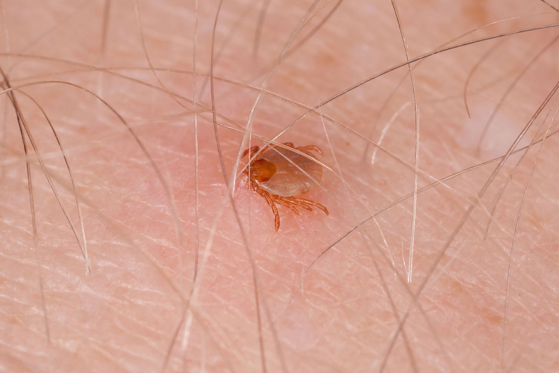 男阴虱虫的症状图片图片