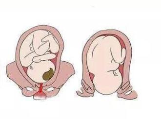 什么是开宫口?生产前你多了解,才不会在临产时乱了手脚