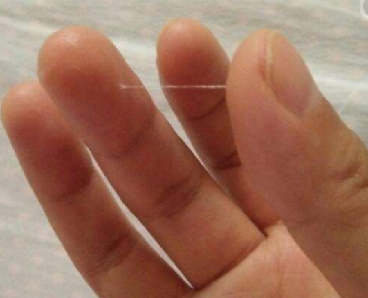 若内裤出现这种情况,可能是"排卵期"到了,备孕夫妻做好准备!