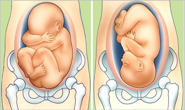 胎儿胎头位于耻骨上图图片