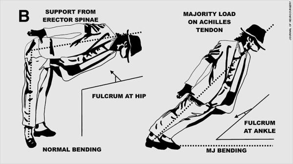 erector spinae图片