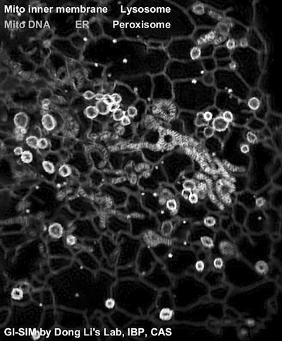 电子显微镜下的水分子图片