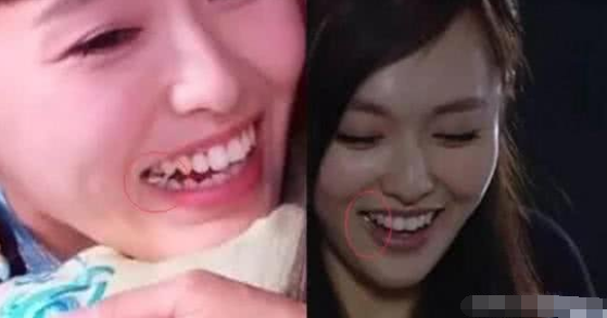 搞笑穿帮镜头:唐嫣拍戏嚼口香糖?尔康假发掉了!看楚乔传我笑了