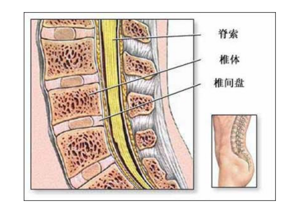 腰间盘突出压迫神经怎么办?教给你不花钱的自我康复疗法!