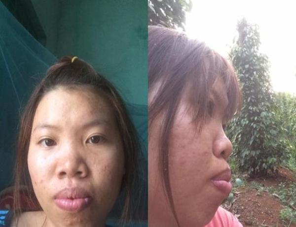 女子太丑找不到男朋友,花费3亿整容后成了香饽饽,被土豪看上