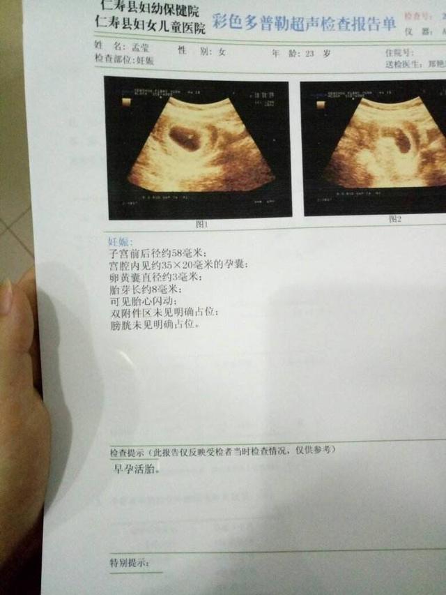 怀孕医院检查结果图片图片