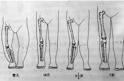 婴儿睡觉腿像青蛙一样图片