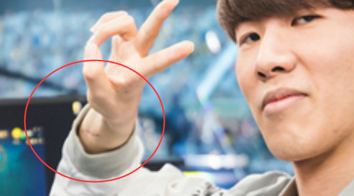 lol:把theshy照顾断手的ig领队疑似被开除,观众心满意足!