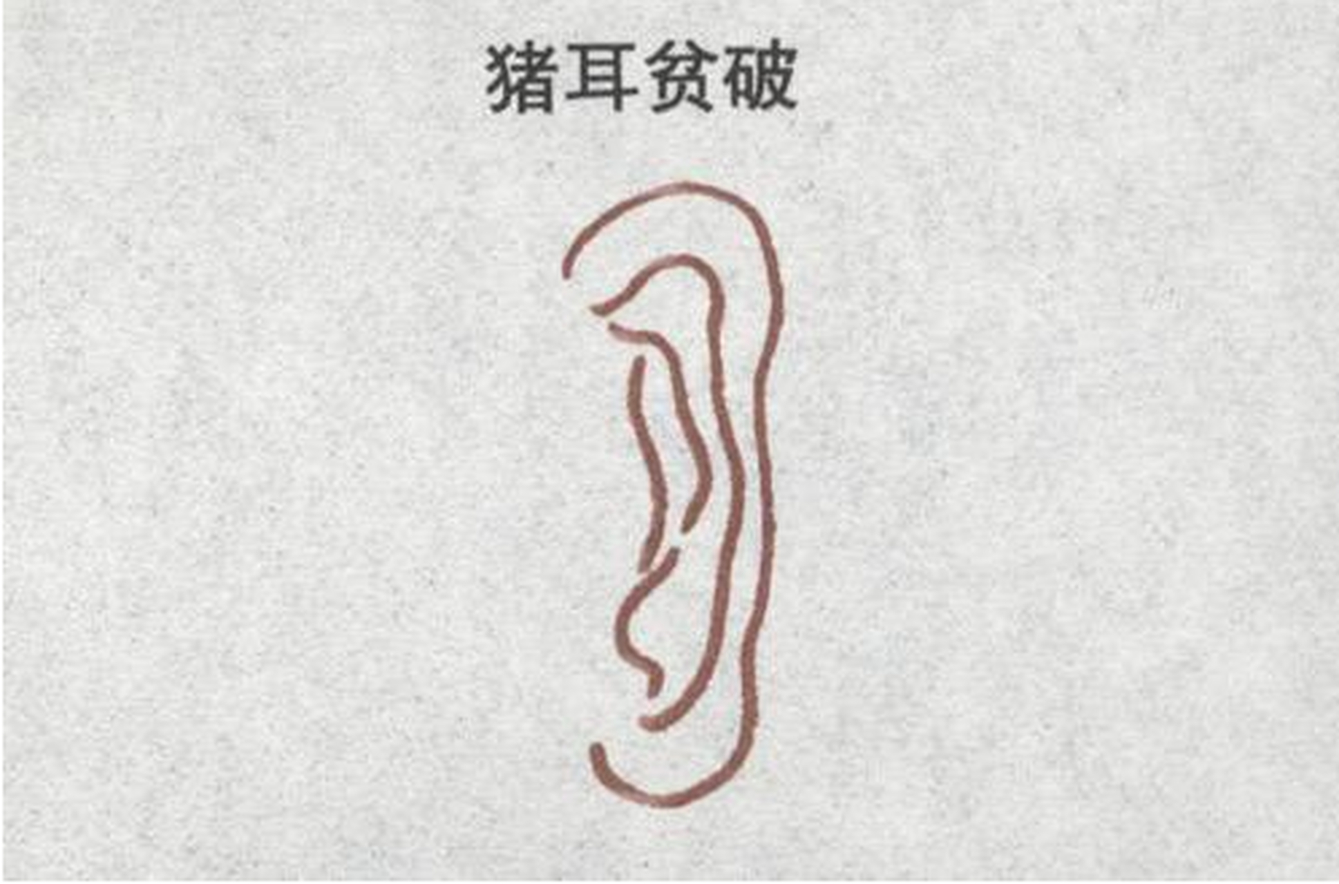 耳朵虽大却有轮无廓,耳虽厚却绵软无力,耳轮略向下垂,没有垂珠,形似猪