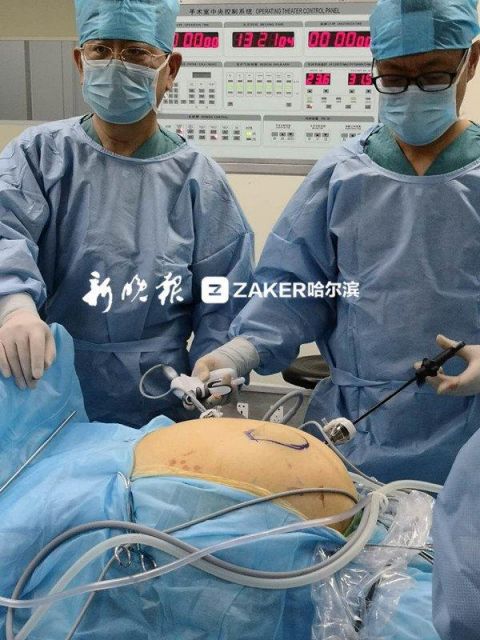 肚皮真能撑破!大娘 10 年天天吃美食不运动"肚皮撑破"了