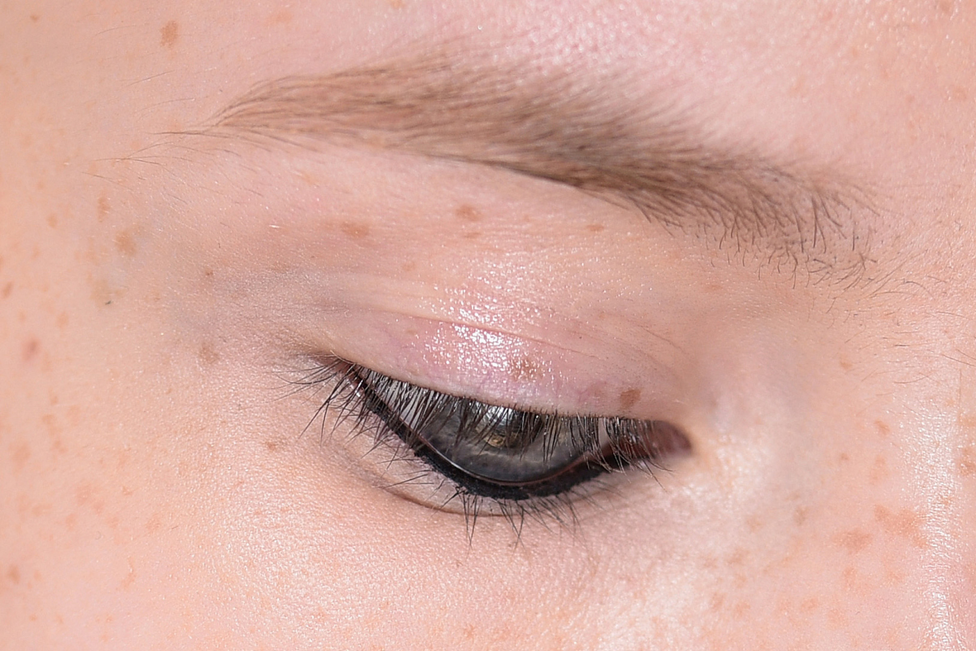 细微磨砂粒的磨砂膏来去除少量脂肪粒,但需要小心谨慎,避免接触眼睛