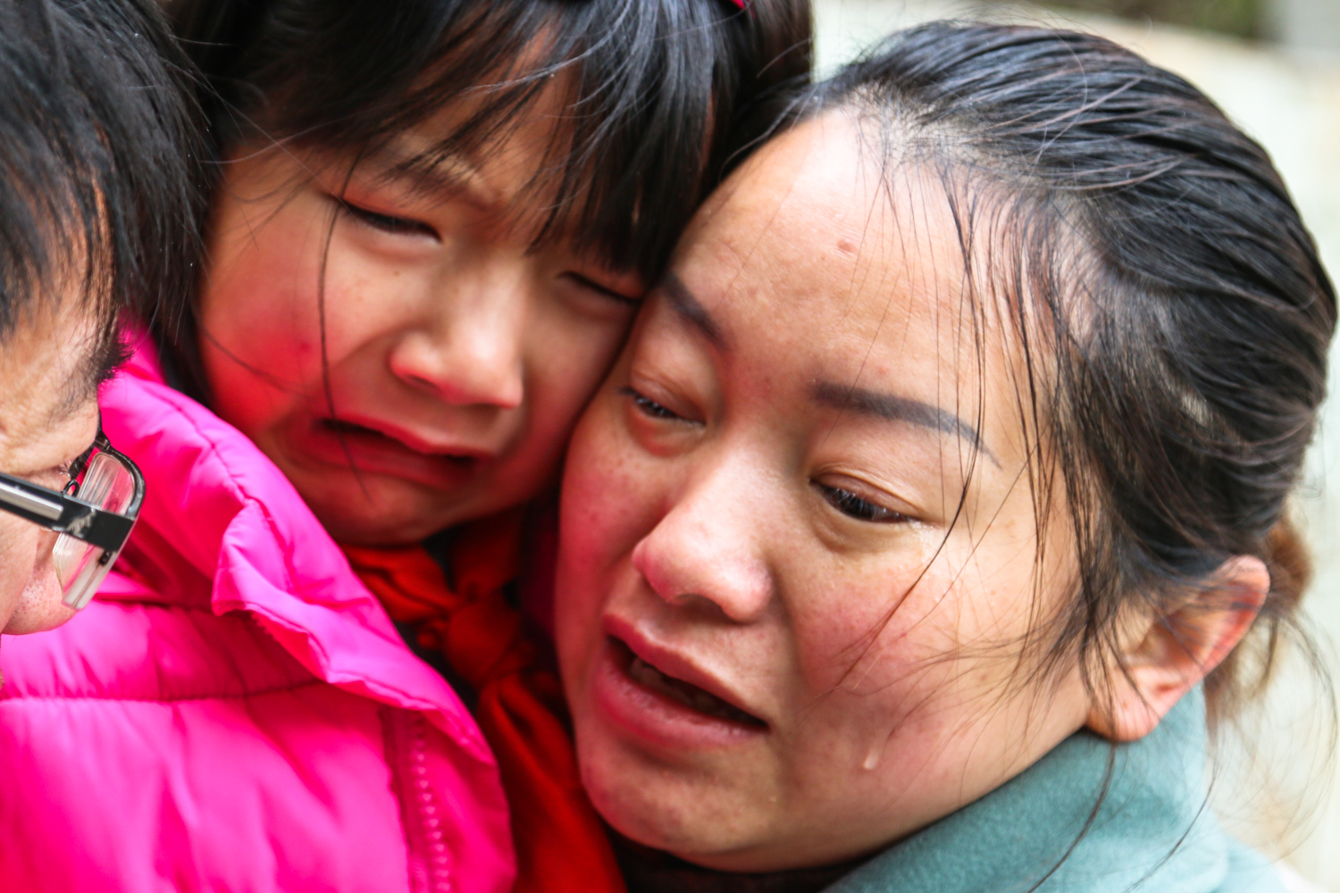 爸爸没钱治疗想抛弃"玻璃"娃娃 没想到女儿留下一封信离家出走